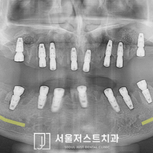후파노